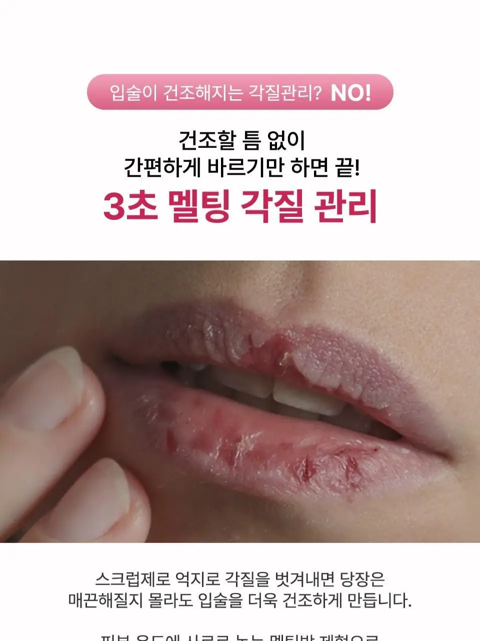 [컬러립밤] 아이소이 립 트리트먼트 밤(퓨어레드) 5g+5g 더블기획 상세페이지 19